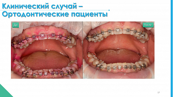 slide-17.jpg