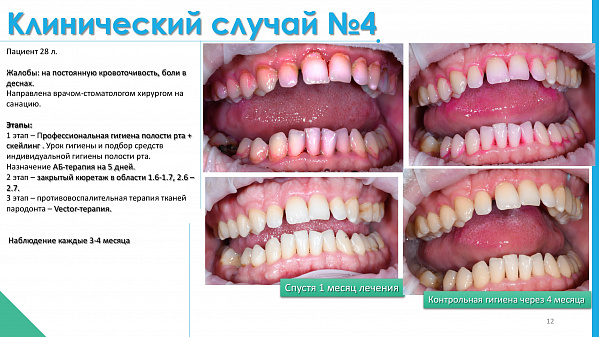 slide-12.jpg