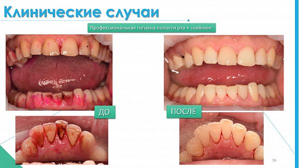 slide-16.jpg
