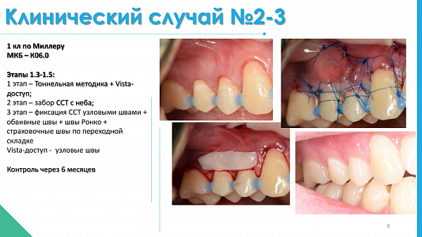 slide-08.jpg