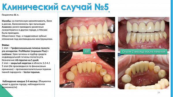 slide-19.jpg