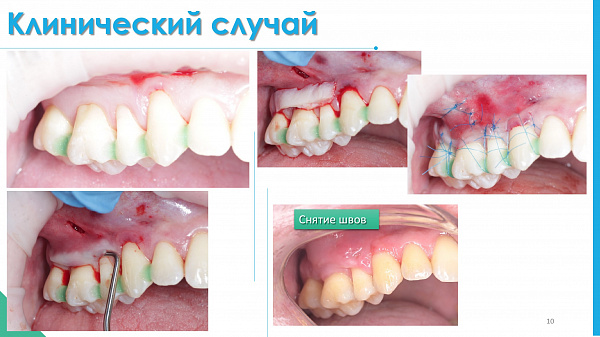 slide-10.jpg