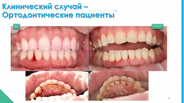 slide-18.jpg