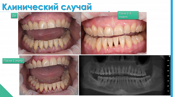 slide-13.jpg