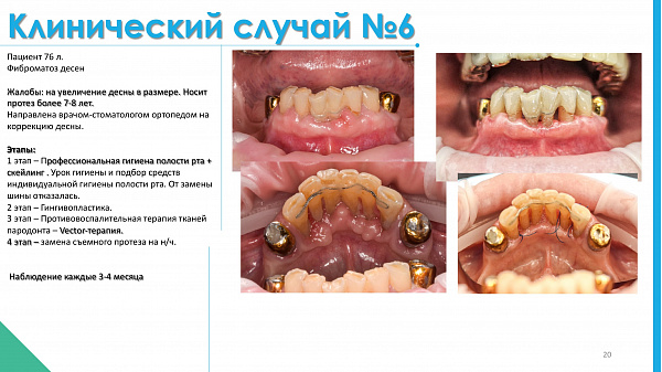 slide-20.jpg