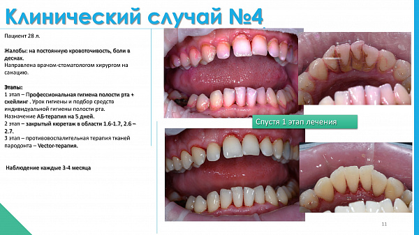 slide-11.jpg