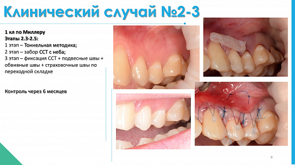 slide-09.jpg