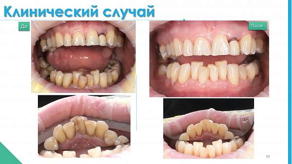 slide-14.jpg